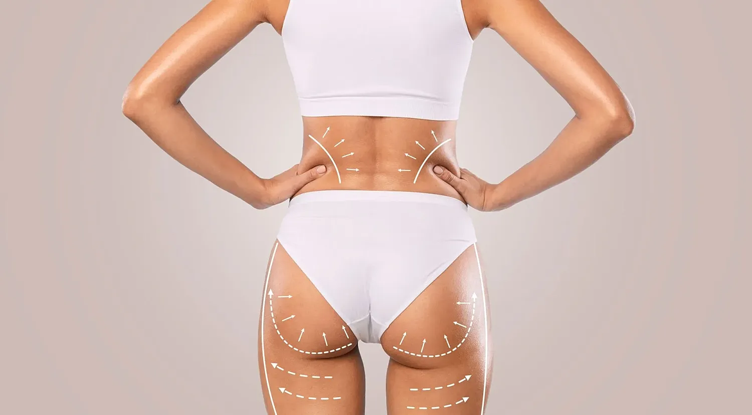 Woman's body with contour lines for enhancement.
